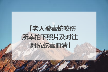 老人被毒蛇咬伤 所幸拍下照片及时注射抗蛇毒血清